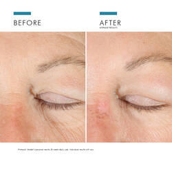 A.G.E. Advanced Eye tummia silmanalusia vastaan