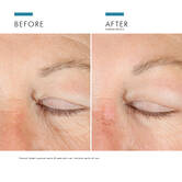 A.G.E. Advanced Eye tummia silmanalusia vastaan