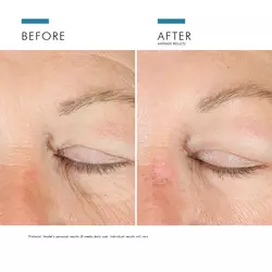 A.G.E. Advanced Eye tummia silmanalusia vastaan